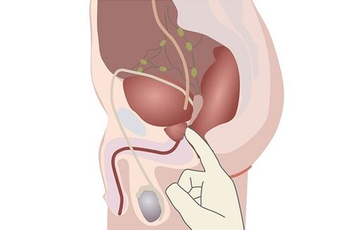 anatomia de la próstata masculina